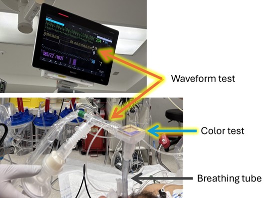 Photograph of both color and waveform tests in use on a patient with a breathing tube in the Emergency Department, as is done during the WAVE study.